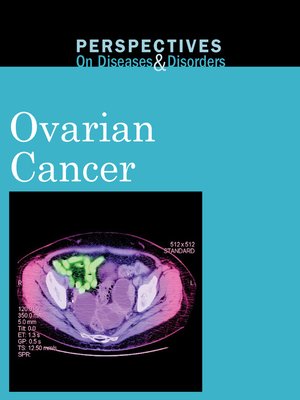 cover image of Ovarian Cancer